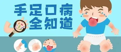 家长们小心！手足口病正在偷袭你家孩子丨新华科普