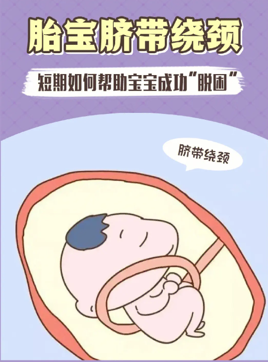 胎儿脐带绕颈一周怎么办|胎儿脐带绕颈1周怎么导致的?